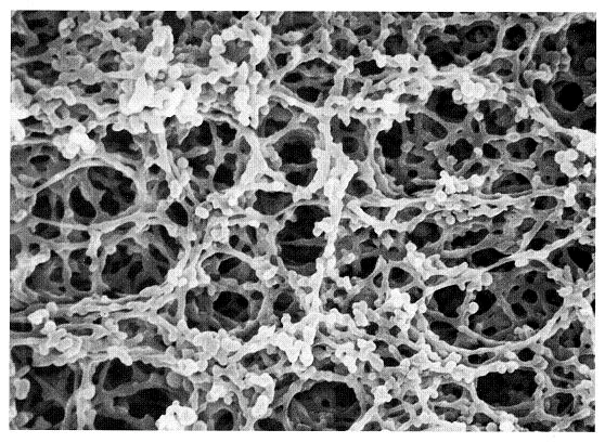 Acetate Membrane